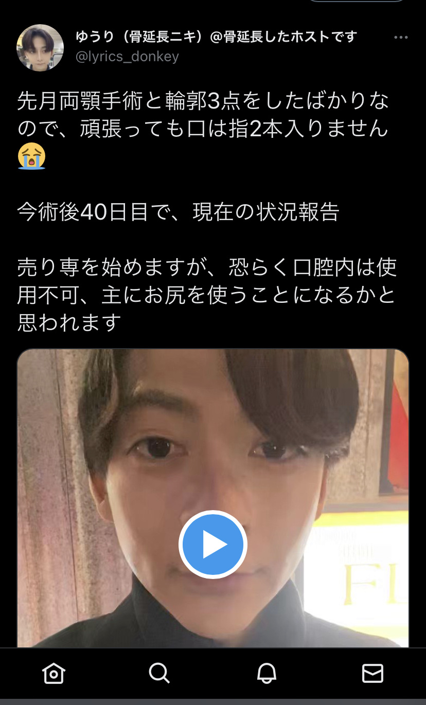 【爆笑】骨延長した奴ら、全員不幸になっていたwwwwwwwwwwwwwwwwwwwwwwww\n_1