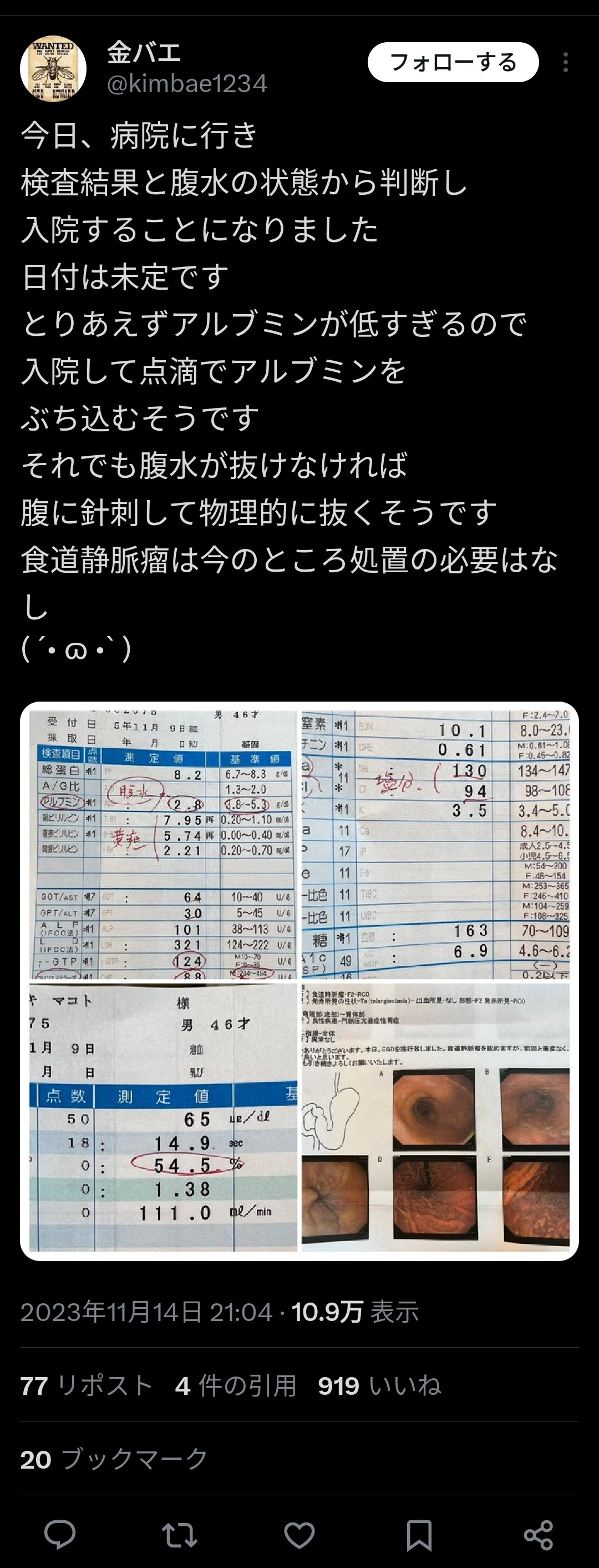 金バエ、腹水が限界突破本当にもう終わりが近い模様  [258739581]\n_2