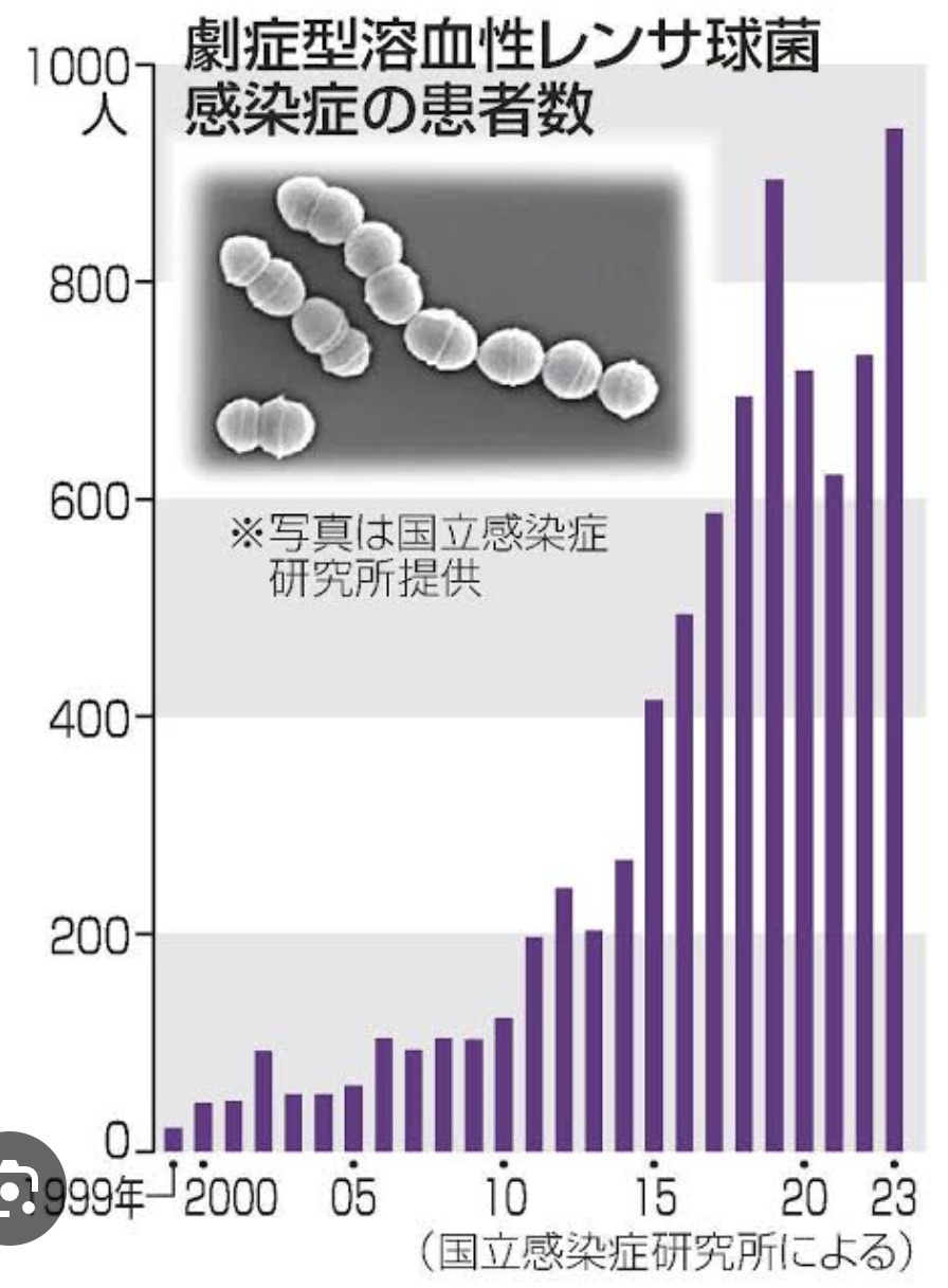 人食いバクテリア「劇症型溶血性レンサ球菌感染症」が5ヶ月で過去最多更新。致○率3割  [256556981]\n_1