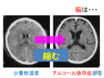 Thumbnail of post image 176