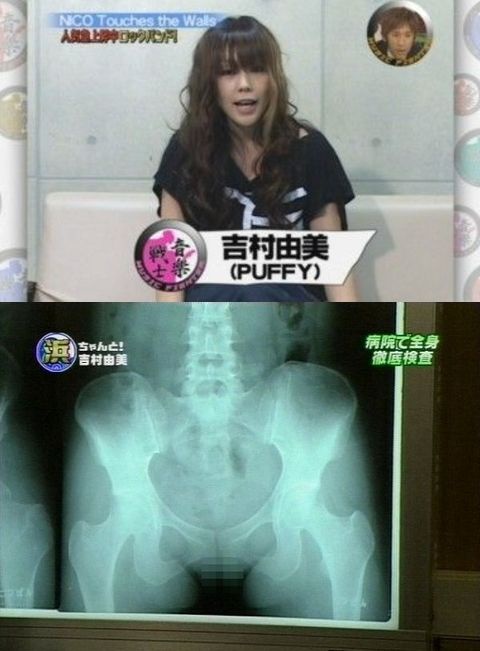 【画像】メルカリで妊娠初期エコー画像の取引がブーム、1枚3000円程度で即落札。  [881878332]
_25_25
