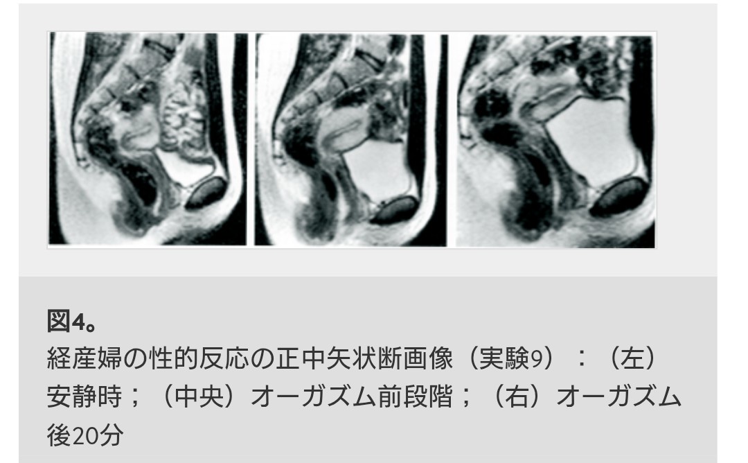 インド人医者「MRI内でSEXさせたけどGスポットなんてないし、潮吹きなんて起きないし、子宮が潰れたりもしなかったよ」  [834239657]
_65_65